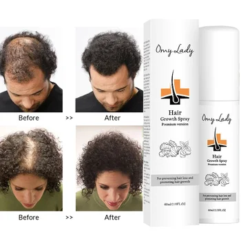 OMY LADY Juuste Kasvu Spray Anti Hair Loss Oluline Kiire Regrowth Vältida Juuste Kahjustatud Hõrenemine Remont, Hooldus Peanaha Ravi 60ml